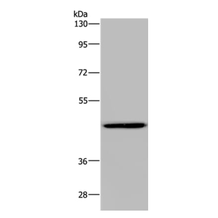 GTPBP10 Antibody from Signalway Antibody (36516) - Antibodies.com