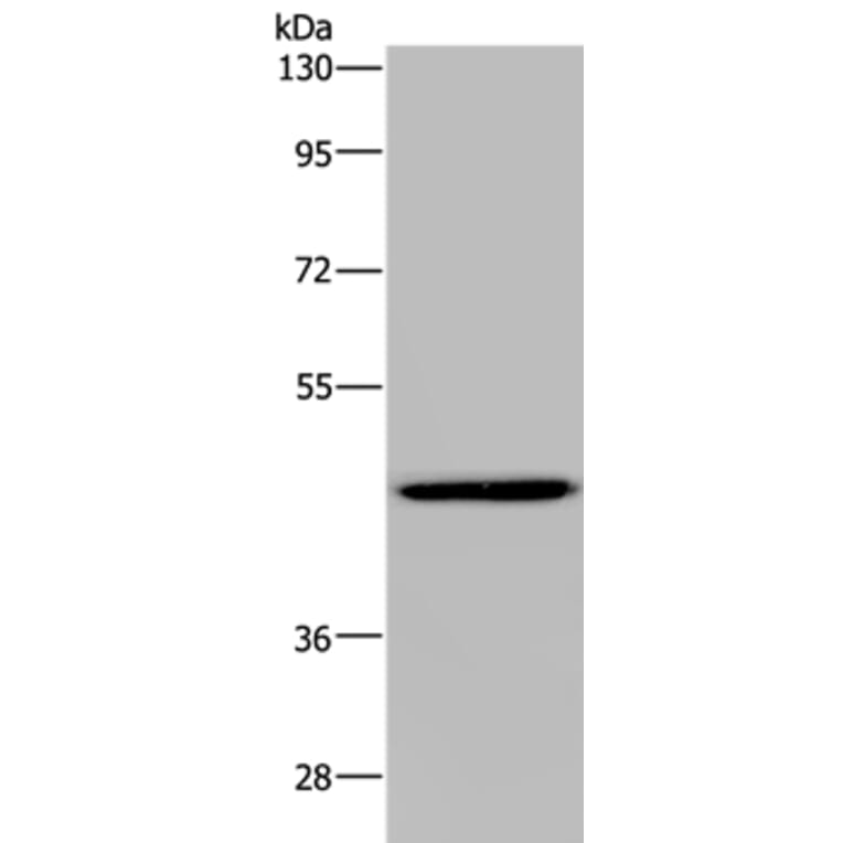 GTPBP10 Antibody from Signalway Antibody (36516) - Antibodies.com