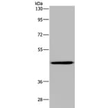 GTPBP10 Antibody from Signalway Antibody (36516) - Antibodies.com