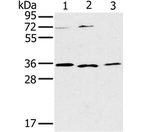 IL22RA2 Antibody from Signalway Antibody (36552) - Antibodies.com