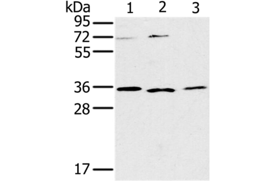 IL22RA2 Antibody from Signalway Antibody (36552) - Antibodies.com