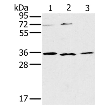 IL22RA2 Antibody from Signalway Antibody (36552) - Antibodies.com