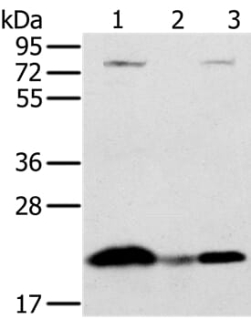 Gel: 10% SDS-PAGE Lysates (from left to right): Raji cell and human liver cancer tissue, hela cell Amount of lysate: 40ug per lane Primary antibody: 1/250 dilution Secondary antibody dilution: 1/8000 Exposure time: 10 seconds