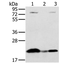 NDUFAF2 Antibody from Signalway Antibody (36618) - Antibodies.com