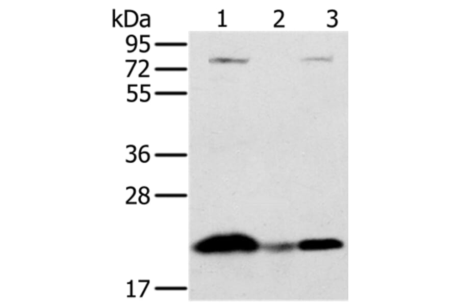 NDUFAF2 Antibody from Signalway Antibody (36618) - Antibodies.com