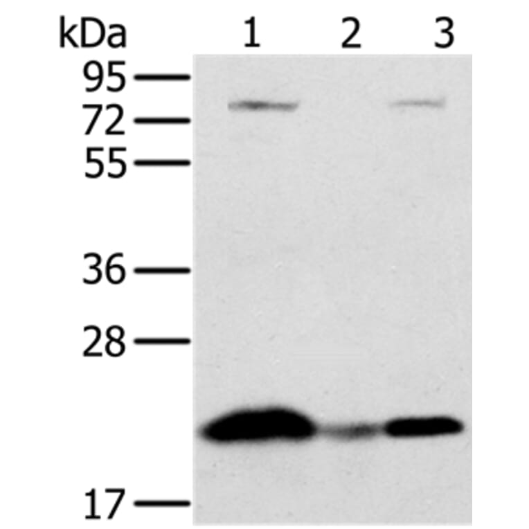 NDUFAF2 Antibody from Signalway Antibody (36618) - Antibodies.com