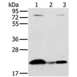 NDUFAF2 Antibody from Signalway Antibody (36618) - Antibodies.com