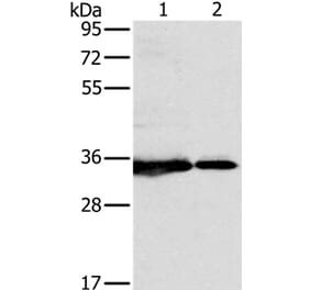 NDUFAF1 Antibody from Signalway Antibody (36637) - Antibodies.com