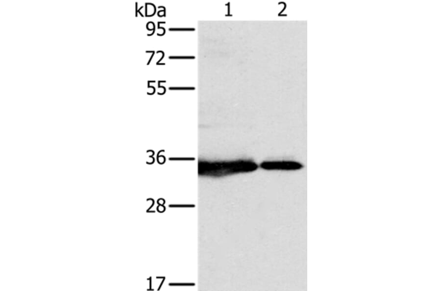 NDUFAF1 Antibody from Signalway Antibody (36637) - Antibodies.com