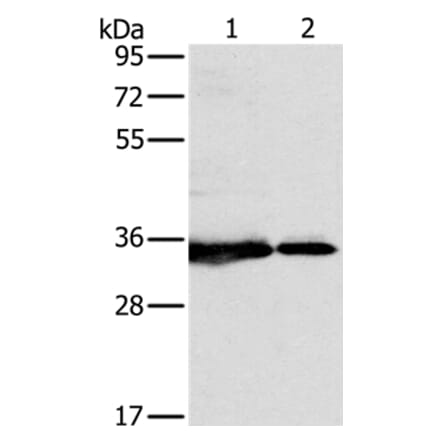 NDUFAF1 Antibody from Signalway Antibody (36637) - Antibodies.com