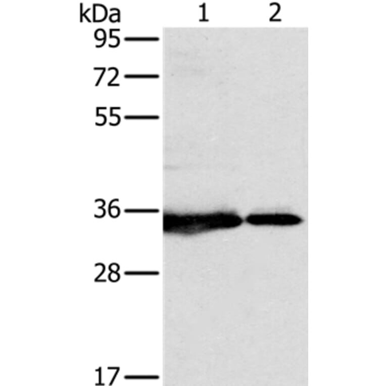 NDUFAF1 Antibody from Signalway Antibody (36637) - Antibodies.com