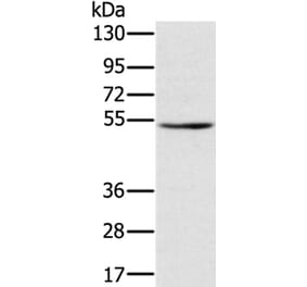 TMPRSS2 Antibody from Signalway Antibody (36703) - Antibodies.com