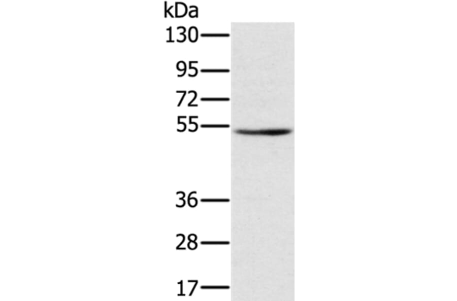 TMPRSS2 Antibody from Signalway Antibody (36703) - Antibodies.com