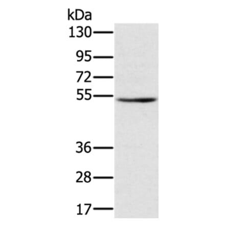 TMPRSS2 Antibody from Signalway Antibody (36703) - Antibodies.com
