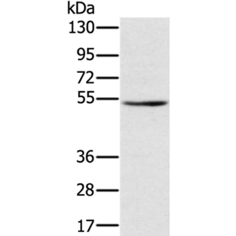 TMPRSS2 Antibody from Signalway Antibody (36703) - Antibodies.com