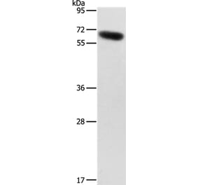 SLC2A12 Antibody from Signalway Antibody (36906) - Antibodies.com