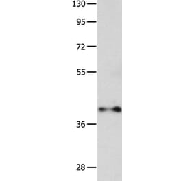 MADCAM1 Antibody from Signalway Antibody (36963) - Antibodies.com