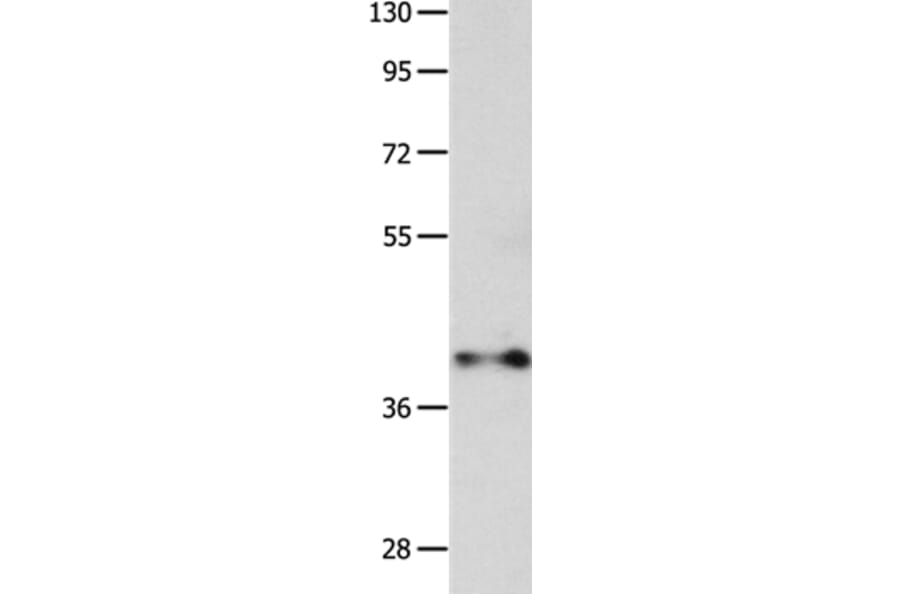 MADCAM1 Antibody from Signalway Antibody (36963) - Antibodies.com