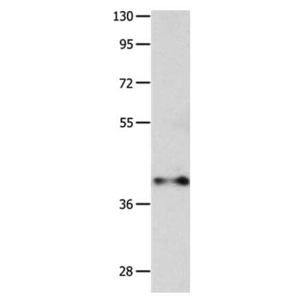 MADCAM1 Antibody from Signalway Antibody (36963) - Antibodies.com