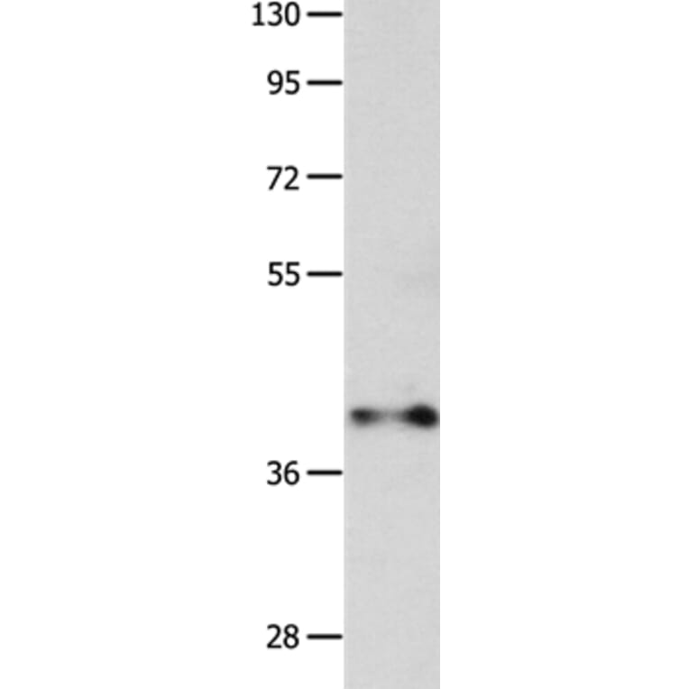 MADCAM1 Antibody from Signalway Antibody (36963) - Antibodies.com