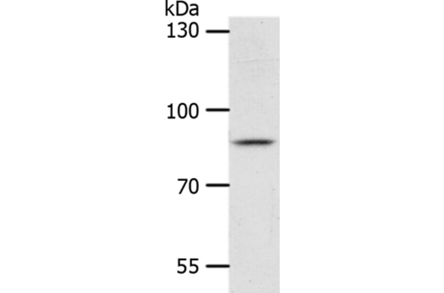 ANKRD28 Antibody from Signalway Antibody (37103) - Antibodies.com