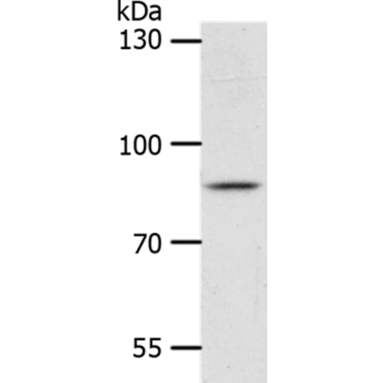 ANKRD28 Antibody from Signalway Antibody (37103) - Antibodies.com