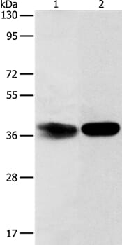 Gel: 12% SDS-PAGE Lysates (from left to right): Hela cell and mouse kidney tissue Amount of lysate: 40ug per lane Primary antibody: 1/500 dilution Secondary antibody dilution: 1/8000 Exposure time: 2 minutes