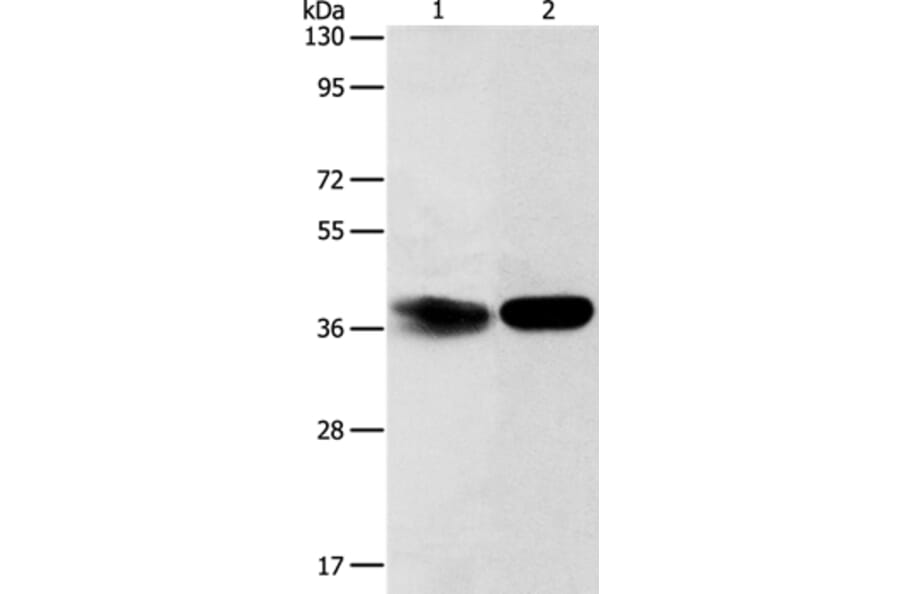 ADPRHL2 Antibody from Signalway Antibody (37352) - Antibodies.com