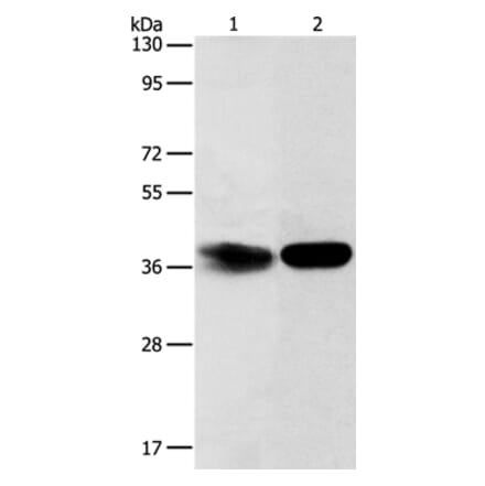 ADPRHL2 Antibody from Signalway Antibody (37352) - Antibodies.com