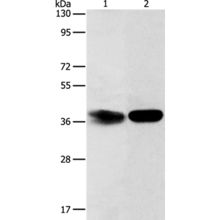ADPRHL2 Antibody from Signalway Antibody (37352) - Antibodies.com