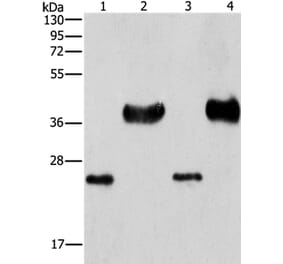 LIN28B Antibody from Signalway Antibody (37362) - Antibodies.com