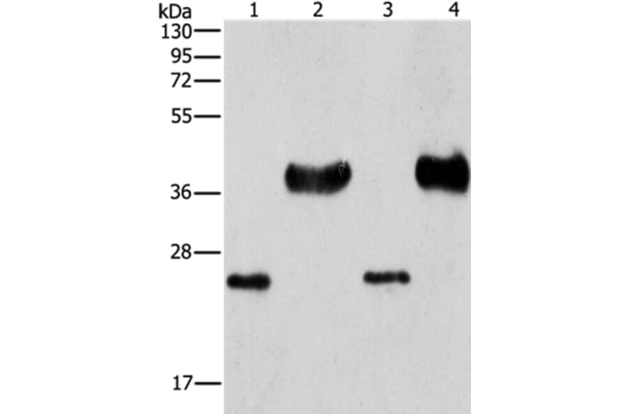 LIN28B Antibody from Signalway Antibody (37362) - Antibodies.com