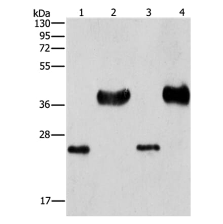 LIN28B Antibody from Signalway Antibody (37362) - Antibodies.com