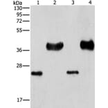 LIN28B Antibody from Signalway Antibody (37362) - Antibodies.com