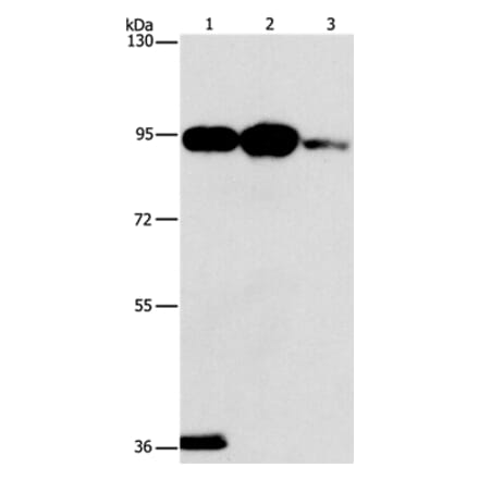 PLA2G4B Antibody from Signalway Antibody (37499) - Antibodies.com