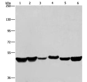 HNRNPH1 Antibody from Signalway Antibody (37625) - Antibodies.com