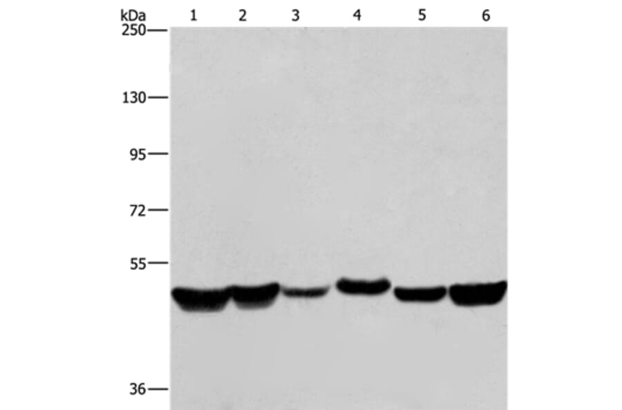 HNRNPH1 Antibody from Signalway Antibody (37625) - Antibodies.com