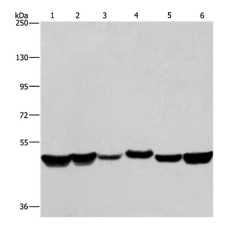 HNRNPH1 Antibody from Signalway Antibody (37625) - Antibodies.com