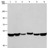 HNRNPH1 Antibody from Signalway Antibody (37625) - Antibodies.com