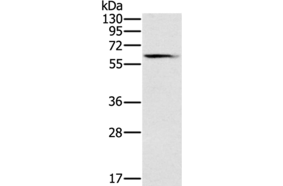 SLC45A3 Antibody from Signalway Antibody (37801) - Antibodies.com