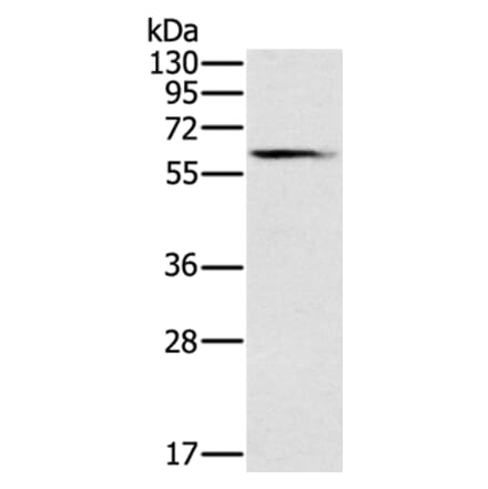 SLC45A3 Antibody from Signalway Antibody (37801) - Antibodies.com