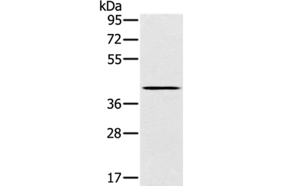 SLC14A1 Antibody from Signalway Antibody (37927) - Antibodies.com