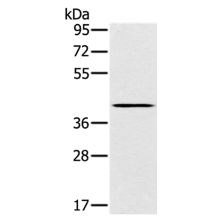 SLC14A1 Antibody from Signalway Antibody (37927) - Antibodies.com