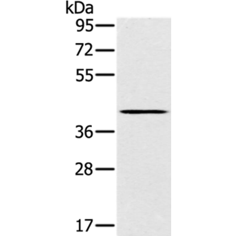 SLC14A1 Antibody from Signalway Antibody (37927) - Antibodies.com