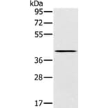 SLC14A1 Antibody from Signalway Antibody (37927) - Antibodies.com