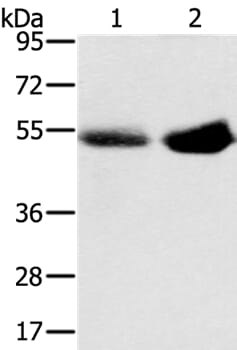Gel: 8% SDS-PAGE Lysates (from left to right): Human placenta and plasma tissue Amount of lysate: 40ug per lane Primary antibody: 1/200 dilution Secondary antibody dilution: 1/8000 Exposure time: 2 minutes