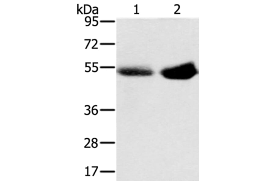 SLC13A3 Antibody from Signalway Antibody (37949) - Antibodies.com