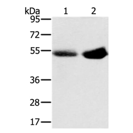 SLC13A3 Antibody from Signalway Antibody (37949) - Antibodies.com