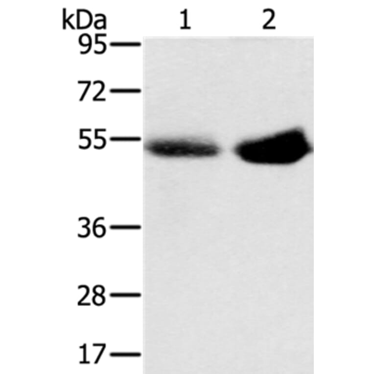 SLC13A3 Antibody from Signalway Antibody (37949) - Antibodies.com