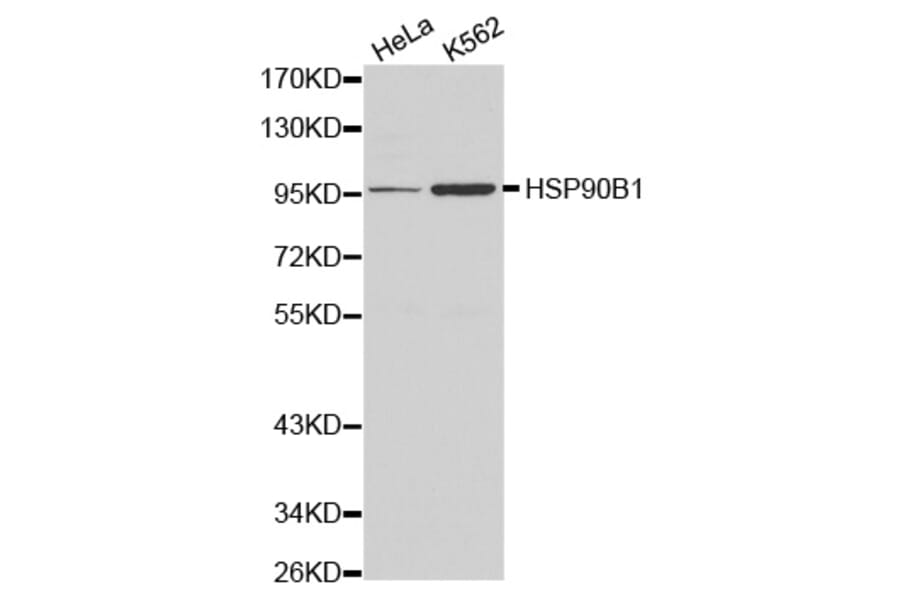 Western blot - HSP90B1 antibody from Signalway Antibody (38161) - Antibodies.com
